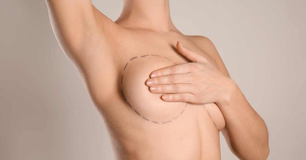 Qu'est ce que la technique composite pour la poitrine