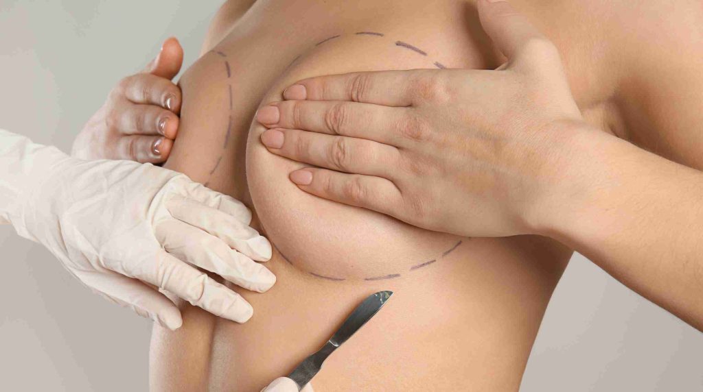 Cicatrice de réduction mammaire : évolution et conseils