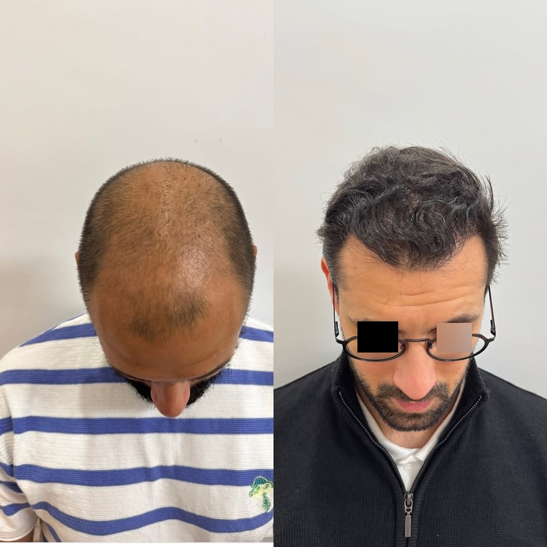 Cas Dr Alimi : DVI9r7MiEv9 photo 2/3