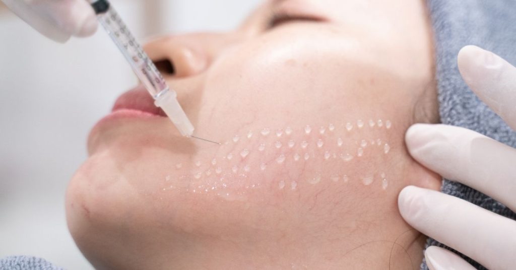 Quelle est la durée des effets de la mésothérapie ?