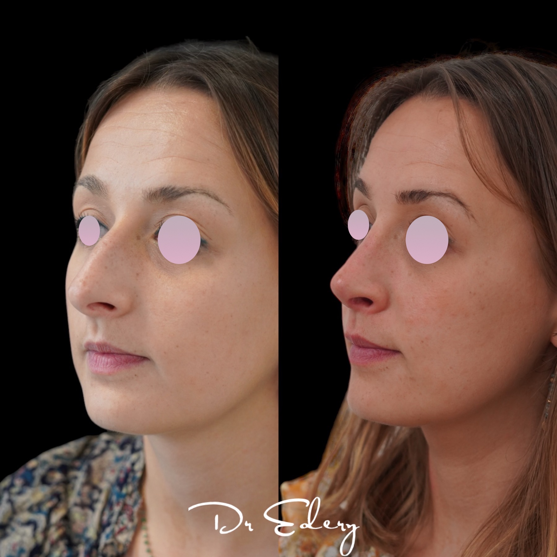 Cas clinique, Dr Edery (photo 3/3)