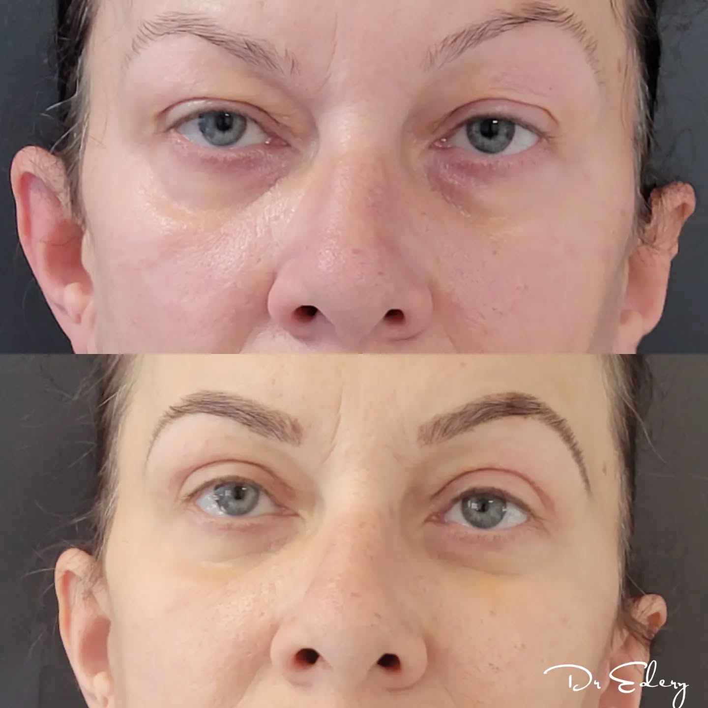 Cas Dr Edery : CdBlftLs2i1 photo 2/3