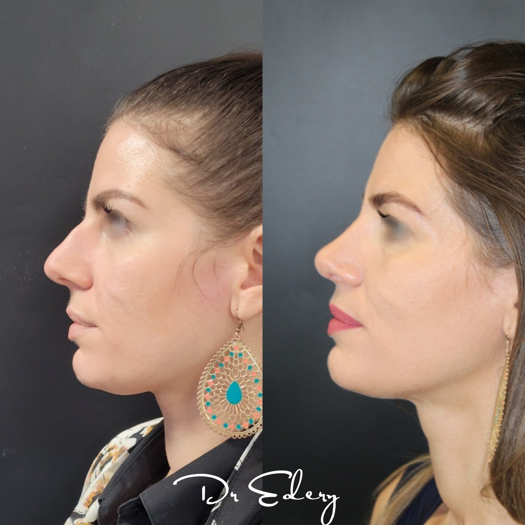 Cas Dr Edery : CivPExtolV9 photo 1/2