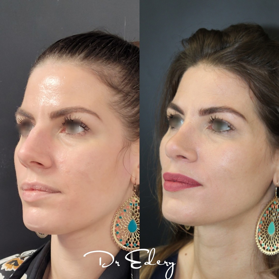Cas Dr Edery : CivPExtolV9 photo 2/2