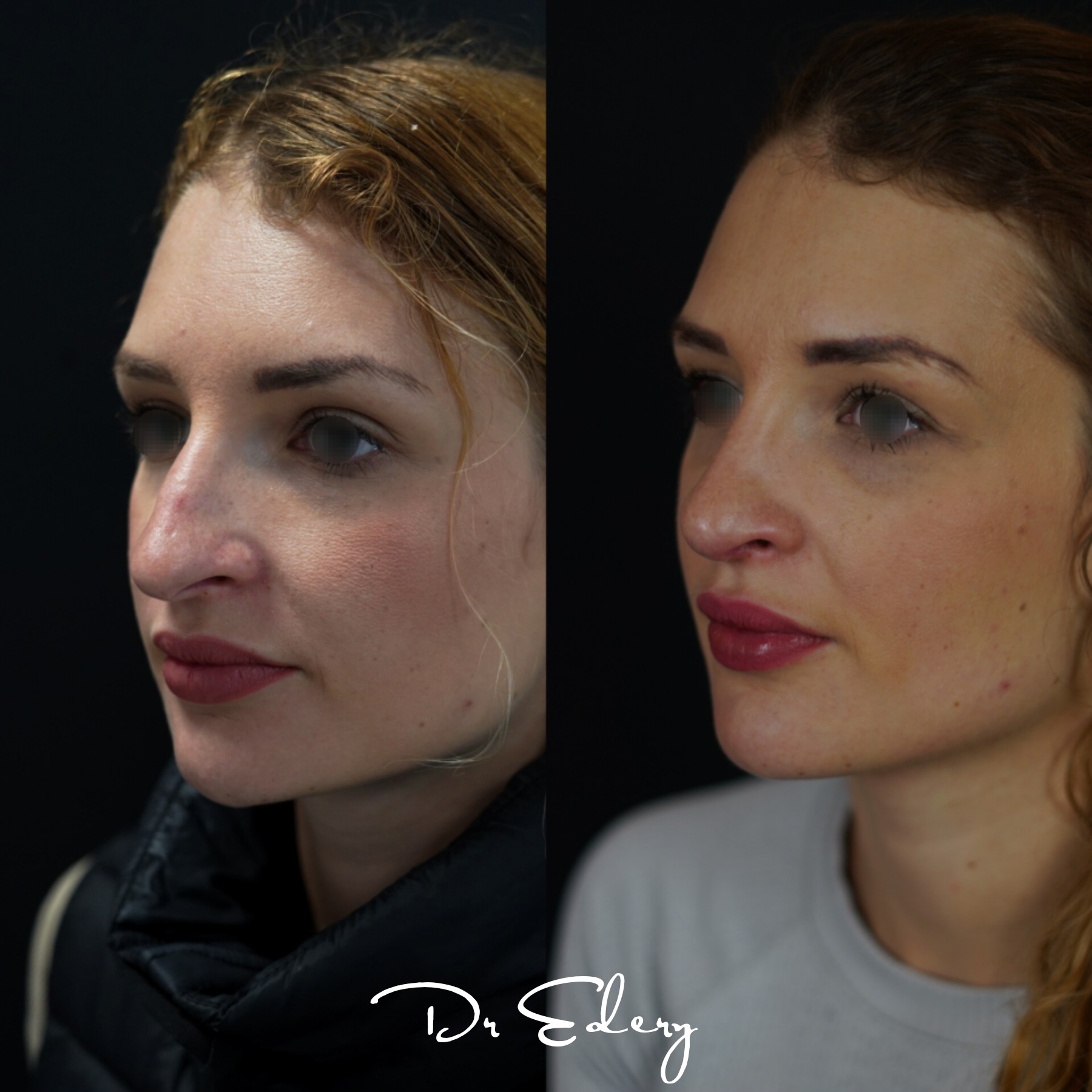 Cas Dr Edery : CnwaS0RoIjG photo 2/3