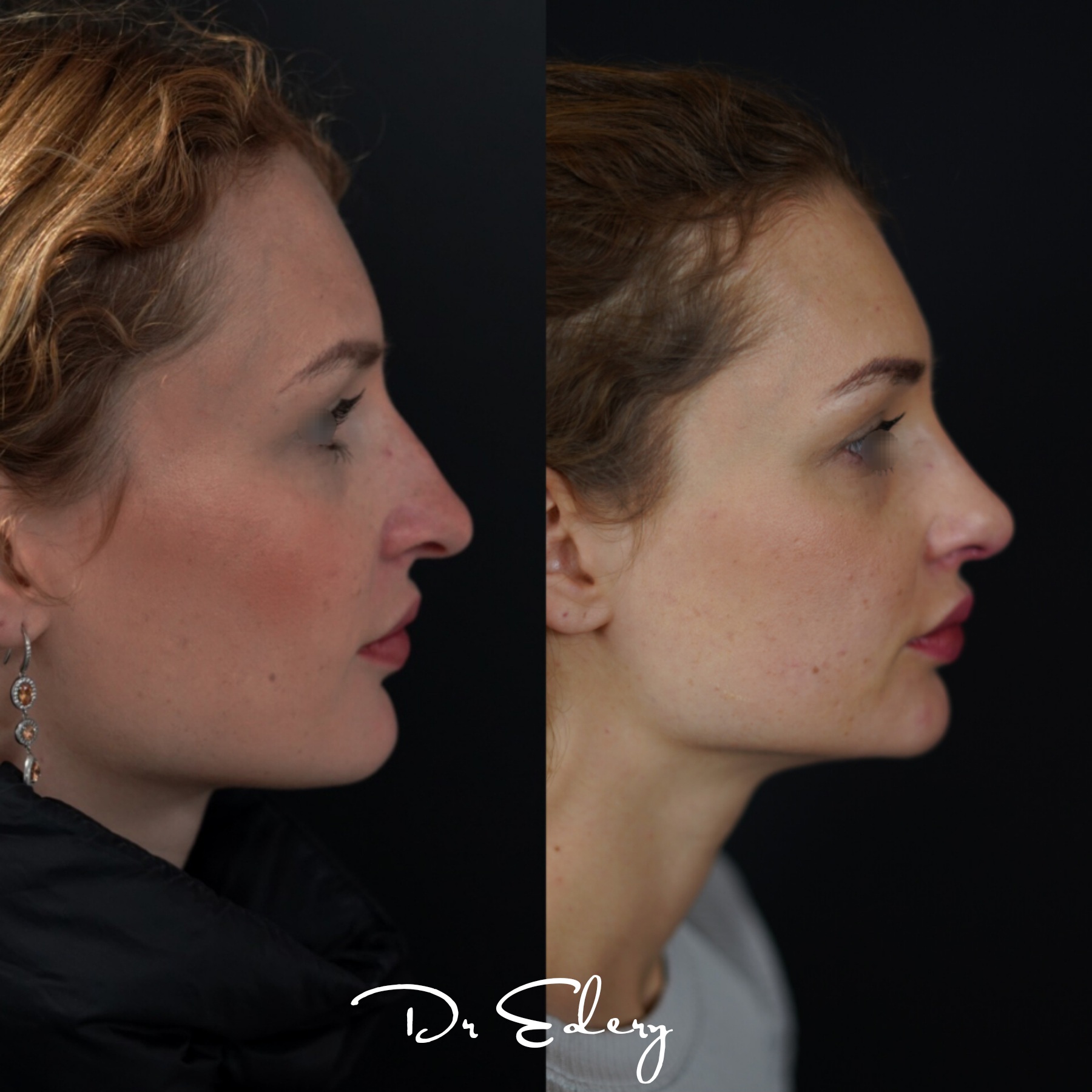 Cas Dr Edery : CnwaS0RoIjG photo 3/3